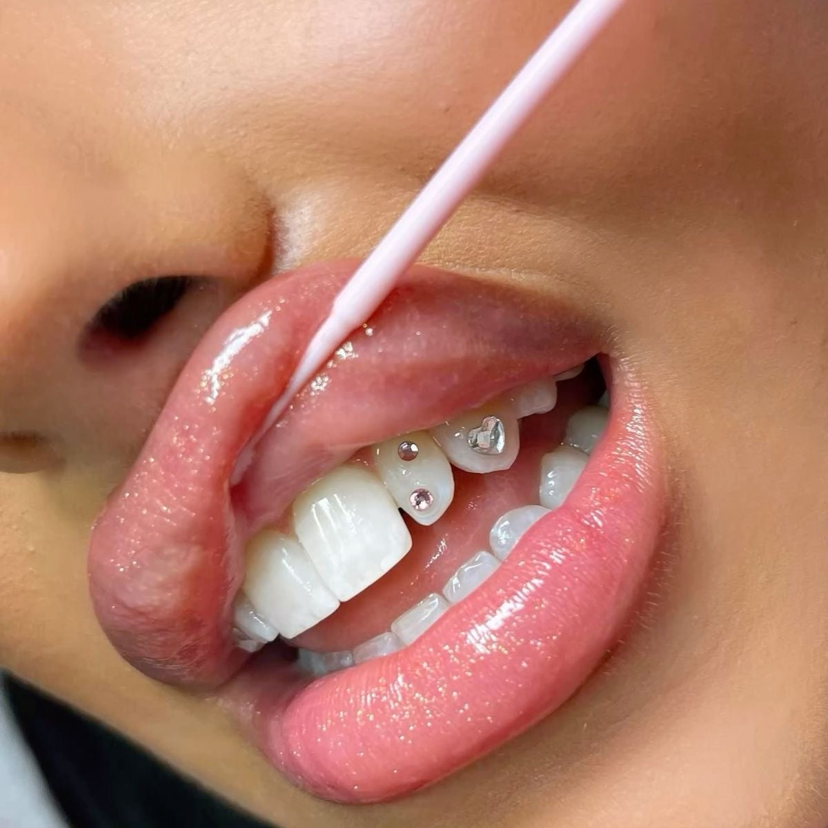 Tooth Gems Online Ebook Schulung mit Zertifikat
